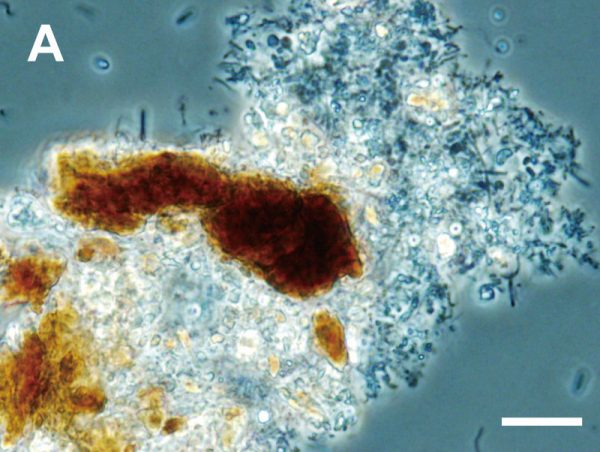 海底下約2kmの石炭層のコアサンプルから培養された世界最深部の海底下微生物群集。A：石炭層に付着する微生物細胞と、C：胞子様の細胞（矢印）を示す光学顕微鏡写真。ともに右下白線のスケールは10㎛ ©︎JAMSTEC