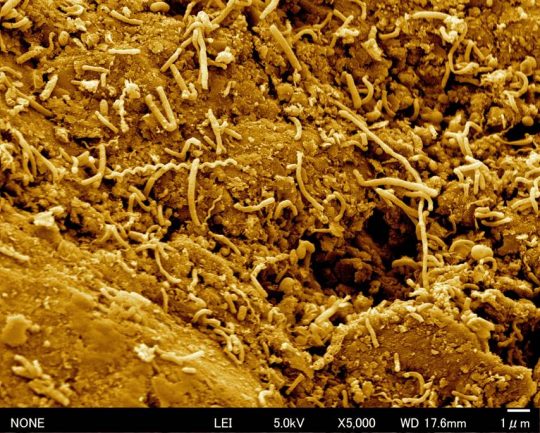 石炭に膨大な数の微生物が付着し増殖している様子がわかる走査型電子顕微鏡写真。海底下約2,000mから採取された石炭層のサンプルを粉末にし、スポンジに染みこませた後、無酸素環境で培養したところ、たくさんの微生物を確認できた ©︎JAMSTEC