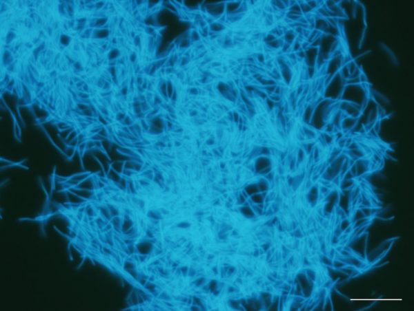 石炭層のサンプルから培養されたメタン生成菌。他の細菌が堆積層に残っている有機物を分解、最終的にメタン生成菌が水素と二酸化炭素からメタンをつくる。石炭の熟成にもこれらの微生物の働きが重要だと考えられている。白線のスケールは10㎛ Image courtesy of Hiroyuki Imachi (Japan Agency for Marine-Earth Science and Technology (JAMSTEC), Japan).
