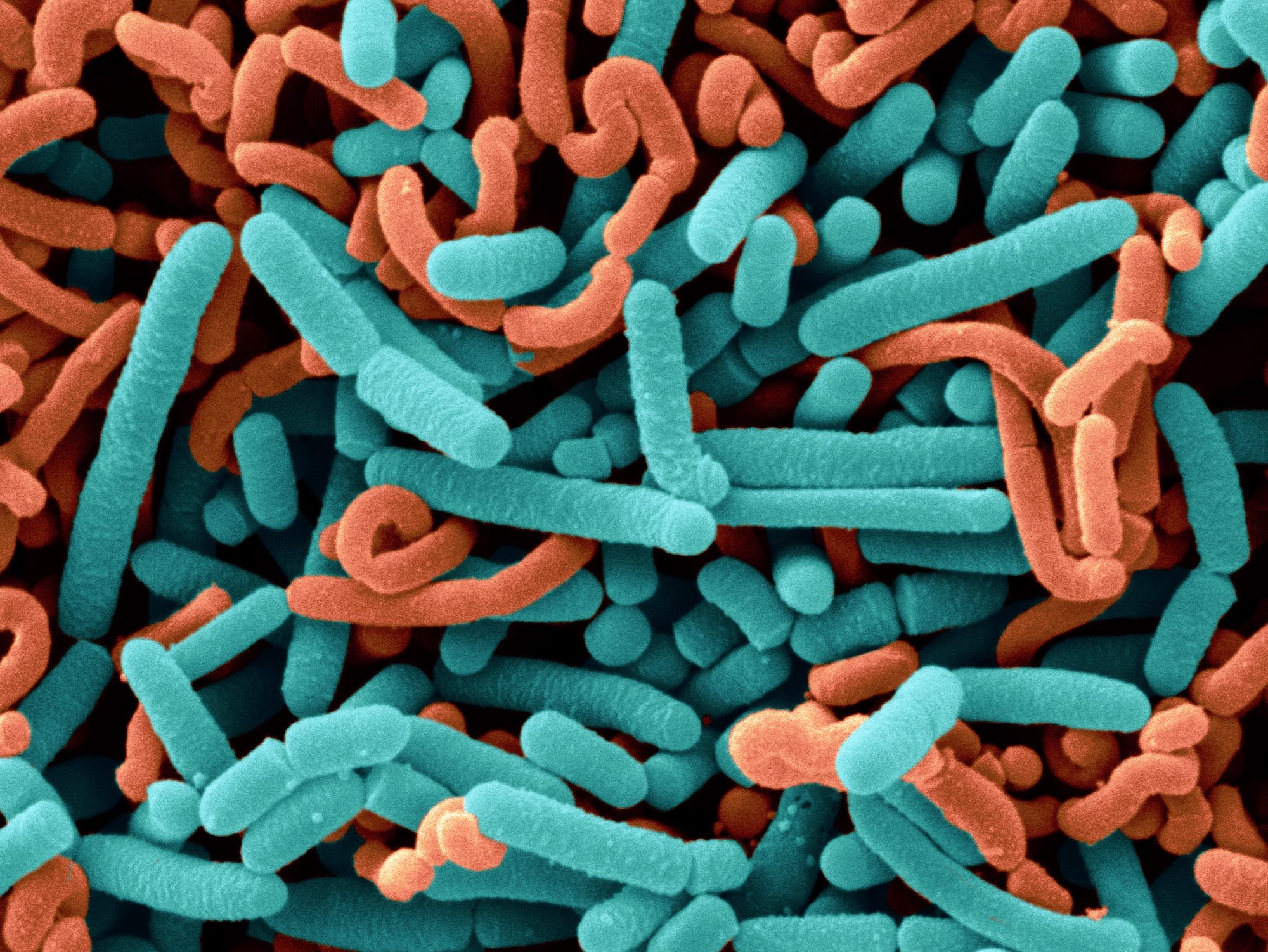 橙：ラクトバチルス カゼイ（Lactobacillus casei：カゼイ菌）は、1891年にチーズから発見された通性嫌気性の乳酸桿菌。整腸作用や免疫調節作用などが認められている。 緑：ラクトバチルス アシドフィルス（Lactobacillus acidophilus：アシドフィルス菌）は、1900年に発見された特に乳児の腸内に多く棲みつく通性嫌気性の乳酸桿菌。整腸作用や感染予防などが報告されている。いずれも「プロバイオティクス（生命の益になるもの）」の効果が見込まれ、市販の発酵乳製品の製造などに使われている。 （引用サイト：ヤクルト中央研究所「菌の図鑑」） ©︎Scimat/Science Source /amanaimages