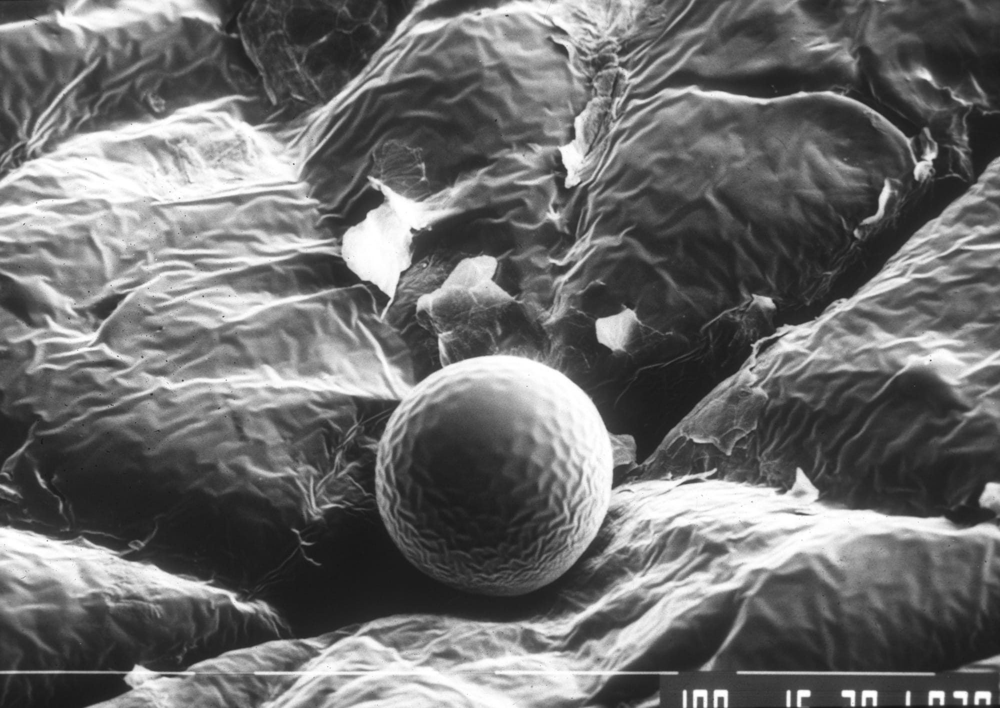 電子顕微鏡で見た汗腺からの汗 Drop of sweat (scanning electron microscopy) ©L’Oréal R&amp;I