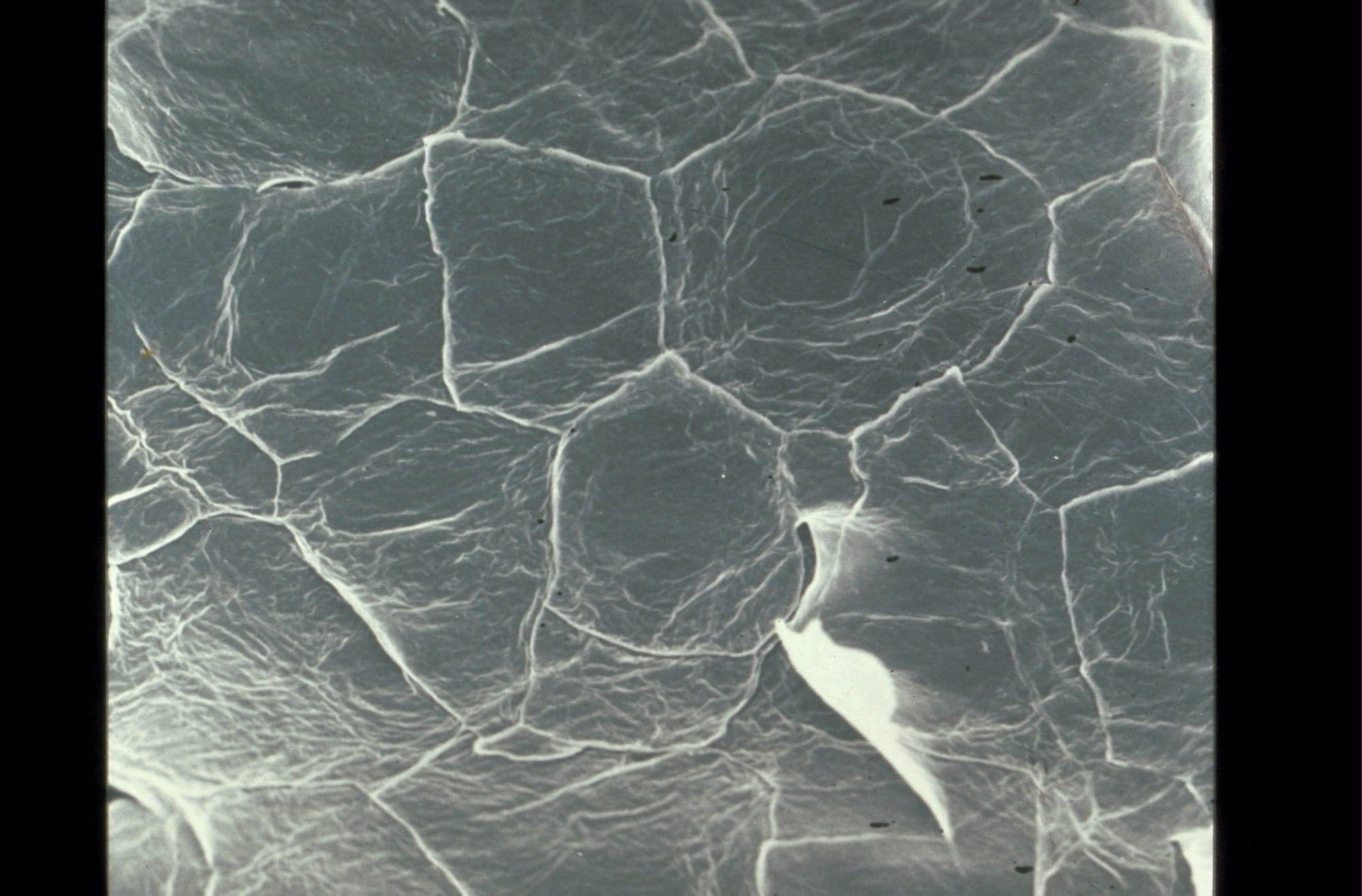 代謝によって角質細胞が落屑（らくせつ）する様子 Carpet of corneocytes, one of which is detaching (scanning electron microscopy) ©L’Oréal R&amp;I