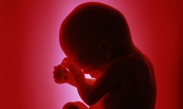 私たちとともにあるウイルスという他者