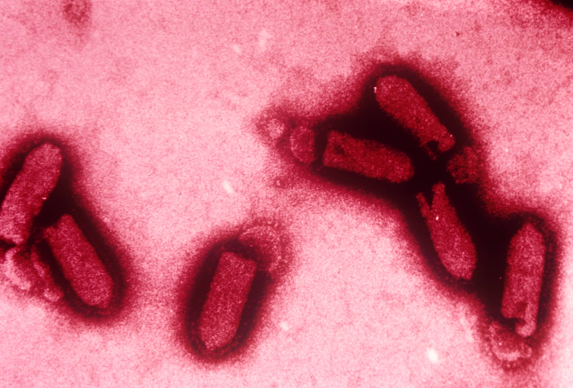 狂犬病ウイルス。ウイルスにはゲノムとして二重らせん構造のDNAを持つものと、一本鎖のRNAを持つものがあり、狂犬病ウイルスや新型コロナウイルス（COVID-19）はRNAウイルスにあたる ©Visuals Unlimited /amanaimages