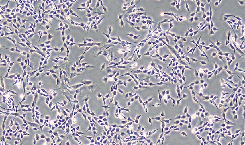 脂肪由来幹細胞（画像提供：ロート製薬株式会社）
