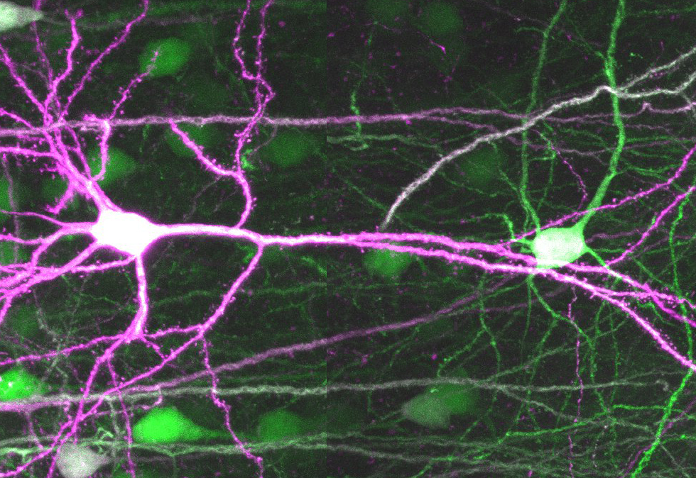 大脳皮質の２／３層のニューロン（出典：多階層精神疾患研究チーム）