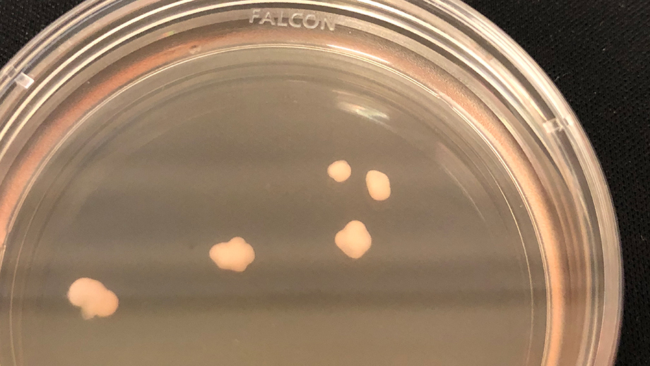 シャーレに配置された５個の脳オルガノイド （出典： Tomoyo Sawada, The Lieber Institute for Brain Development）