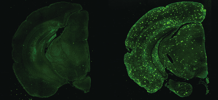 モデルマウス脳内のアミロイド（緑の斑点）左が2か月齢、右が9か月齢のマウス